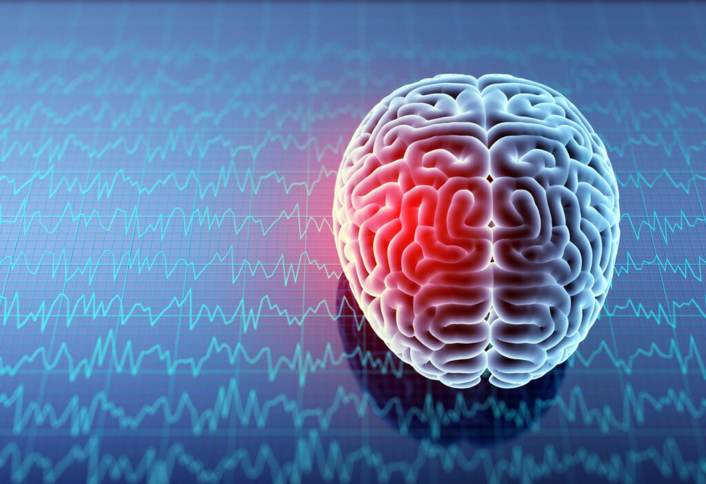 los angeles head injury lawyer